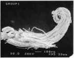SEM Image of Silver Whisker (pig tail)